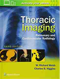 thoracic imaging