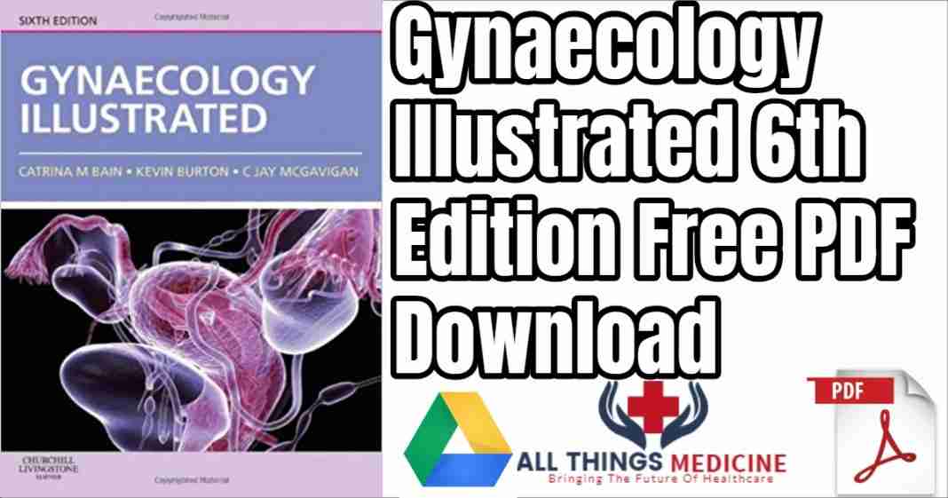 gynaecology illustrated free download