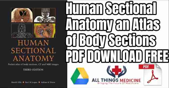 human sectional anatomy