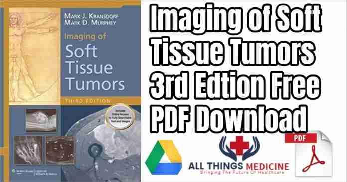 imaging of soft tissue tumors