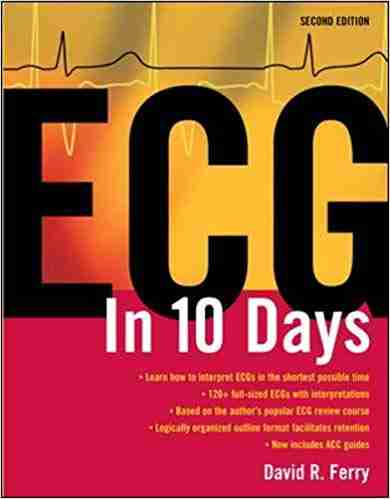 Ecg in 10 days