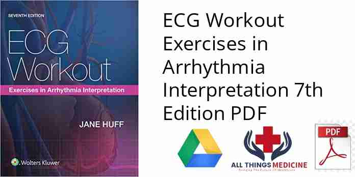 ECG Workout Exercises in Arrhythmia Interpretation 7th Edition PDF
