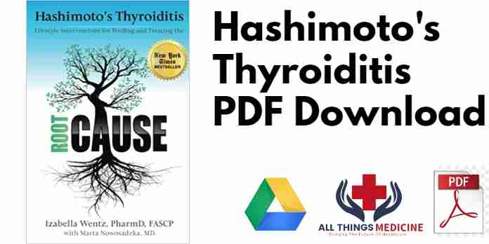 Hashimoto's Thyroiditis PDF