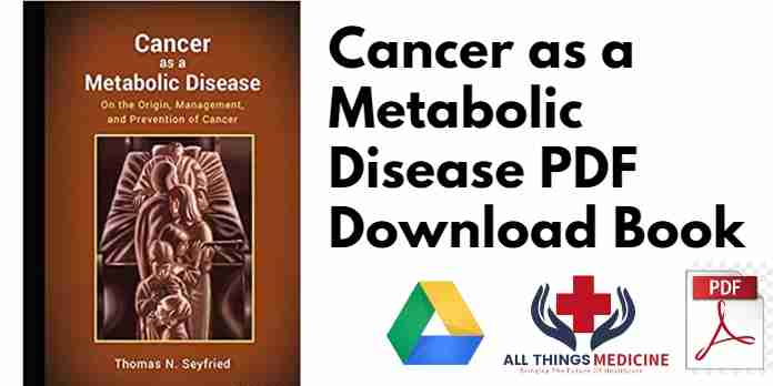 Cancer as a Metabolic Disease PDF
