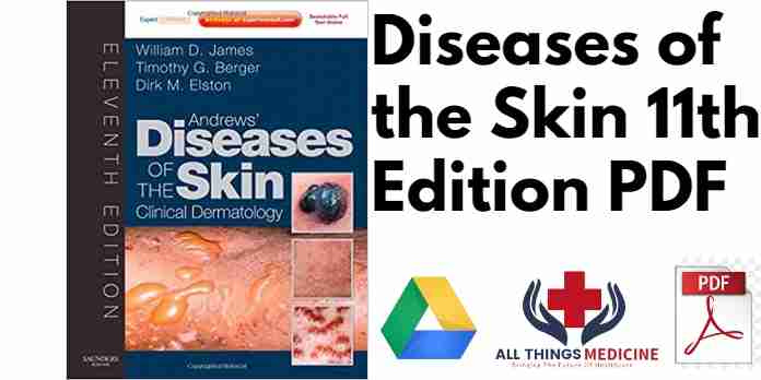 Diseases of the Skin 11th Edition PDF