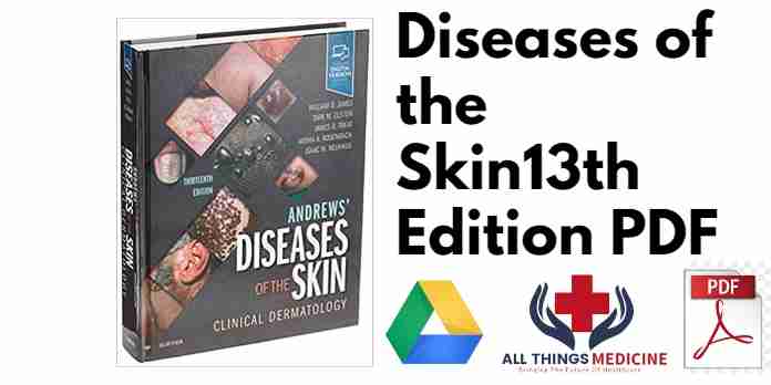 Diseases of the Skin13th Edition PDF