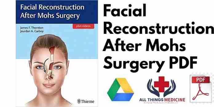 Facial Reconstruction After Mohs Surgery PDF