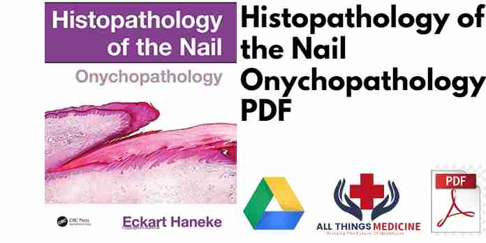 Histopathology of the Nail Onychopathology PDF