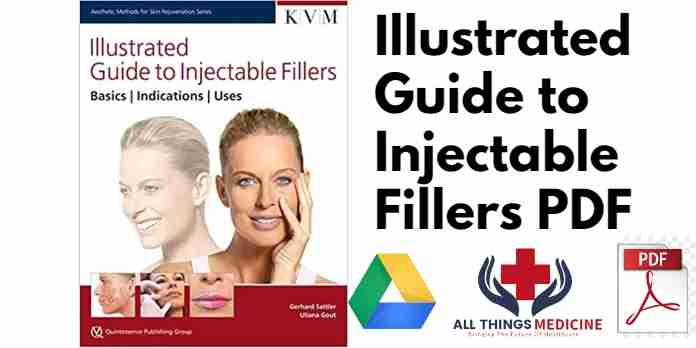 Illustrated Guide to Injectable Fillers PDF