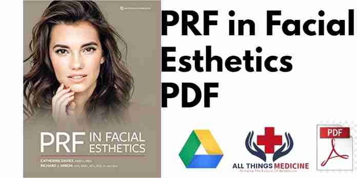 PRF in Facial Esthetics PDF