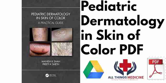 Pediatric Dermatology in Skin of Color PDF
