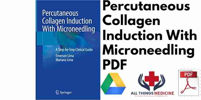 Percutaneous Collagen Induction With Microneedling PDF