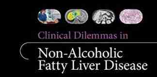 Clinical Dilemmas in Non Alcoholic Fatty Liver Disease PDF