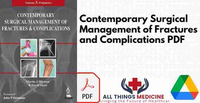 Contemporary Surgical Management of Fractures and Complications PDF