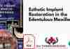 Esthetic Implant Restoration in the Edentulous Maxilla PDF