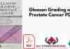 Gleason Grading of Prostate Cancer PDF
