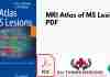 MRI Atlas of MS Lesions PDF