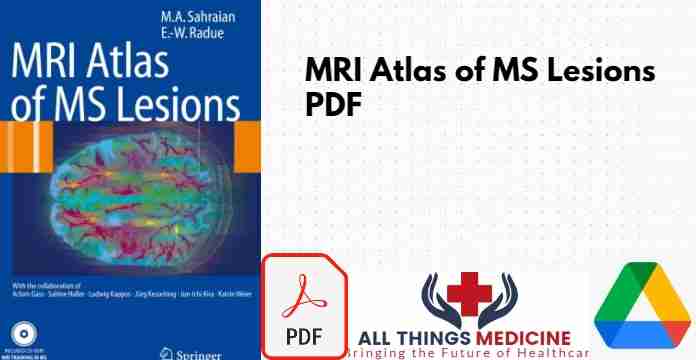 MRI Atlas of MS Lesions PDF