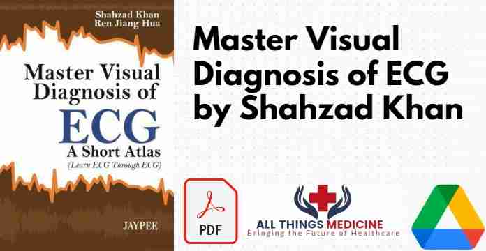 Master Visual Diagnosis of ECG by Shahzad Khan PDF