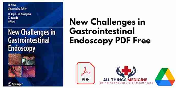 New Challenges in Gastrointestinal Endoscopy PDF