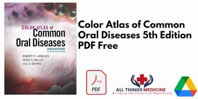 Color Atlas of Common Oral Diseases 5th Edition PDF