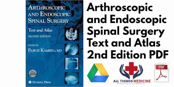 Arthroscopic and Endoscopic Spinal Surgery Text and Atlas 2nd Edition PDF