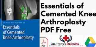 Essentials of Cemented Knee Arthroplasty PDF