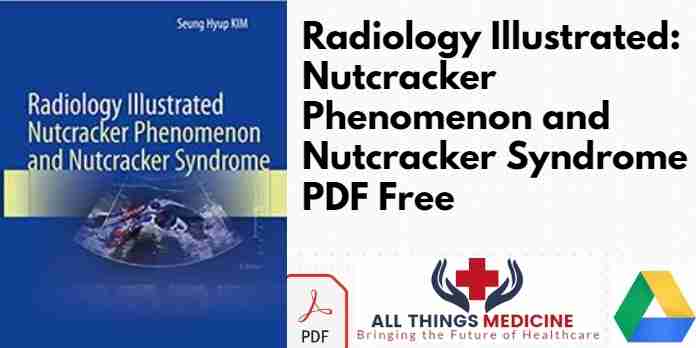 Radiology Illustrated: Nutcracker Phenomenon and Nutcracker Syndrome PDF