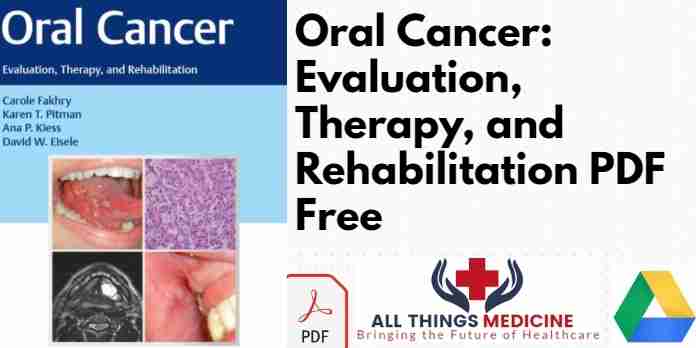 Oral Cancer: Evaluation Therapy and Rehabilitation PDF