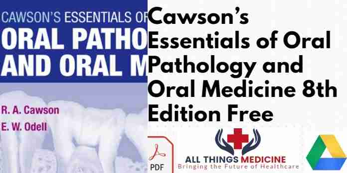 Cawson’s Essentials of Oral Pathology and Oral Medicine 8th Edition PDF
