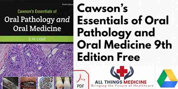 Cawson’s Essentials of Oral Pathology and Oral Medicine 9th Edition PDF