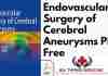 Endovascular Surgery of Cerebral Aneurysms PDF