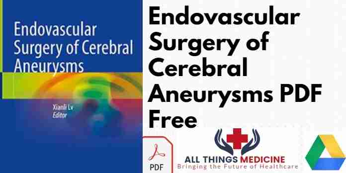Endovascular Surgery of Cerebral Aneurysms PDF