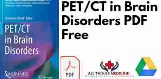 PET/CT in Brain Disorders PDF