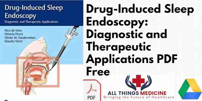 Drug-Induced Sleep Endoscopy: Diagnostic and Therapeutic Applications PDF