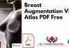 Breast Augmentation Video Atlas PDF