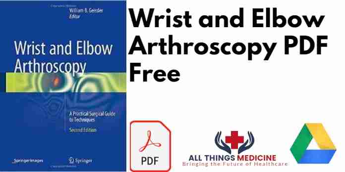 Wrist and Elbow Arthroscopy PDF