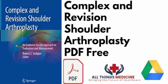 Complex and Revision Shoulder Arthroplasty PDF