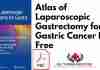 Atlas of Laparoscopic Gastrectomy for Gastric Cancer PDF