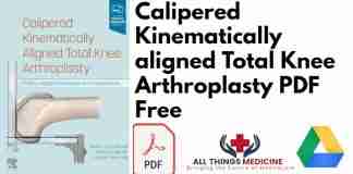 Calipered Kinematically aligned Total Knee Arthroplasty PDF