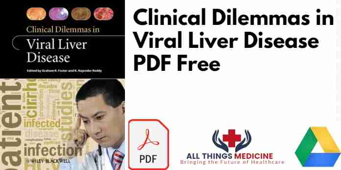 Clinical Dilemmas in Viral Liver Disease PDF