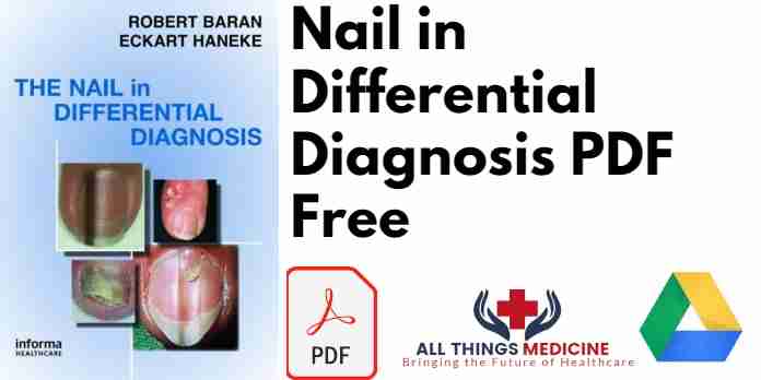 Nail in Differential Diagnosis PDF