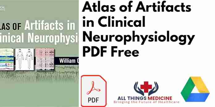 Atlas of Artifacts in Clinical Neurophysiology PDF