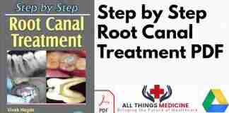 Step by step root canal treatment pdf
