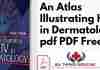 An Atlas Illustrating HIV in Dermatology pdf