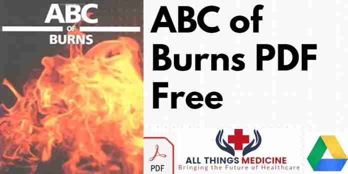 ABC of Burns PDF