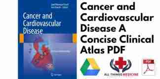 Cancer and Cardiovascular Disease A Concise Clinical Atlas PDF