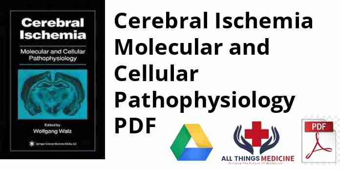 Cerebral Ischemia Molecular and Cellular Pathophysiology PDF