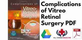 Complications of Vitreo Retinal Surgery PDF