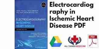 Electrocardiography in Ischemic Heart Disease PDF